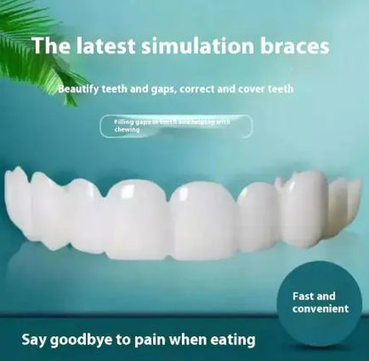 Dental veneers